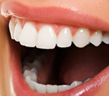 TeethWhiteningWhatYouNeedToKnow