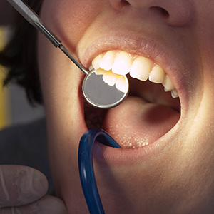 EvenifaRootCanalWontWorkThisProcedureCouldSaveyourTooth