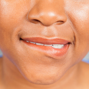 We Can Rid You of That Irritating Lump in Your Mouth You Keep Biting We Can Rid You of That Irritating Lump in Your Mouth You Keep Biting