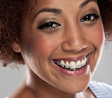 TeethStraighteningItsNotJustForKids