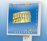 Cad Cam dentistry.