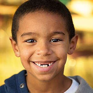 5SignsYourChildMayBeDevelopingaPoorBite