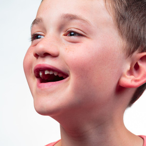 HaveYourChildsChronicMouthBreathingCheckedtoAvoidBiteProblems