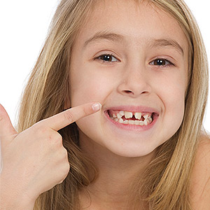 6SignsYourChildCouldBeDevelopingaPoorBite