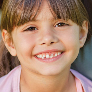 BeontheLookoutforTheseCommonBiteProblemsinChildren