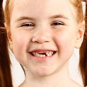 FebruaryFocusesonChildrensDentalHealth