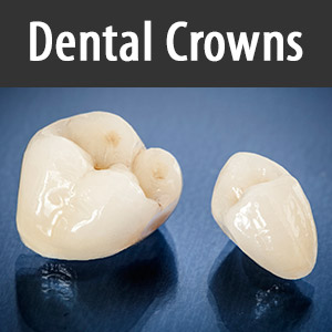 WhatYouNeedToKnowToChoosetheRightDentalCrown