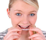 clear aligners.