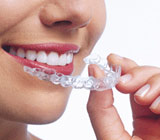 ClearOrthodonticAlignersAreTheyRightForYou