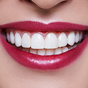 Veneers may Offer a Less Invasive Way to Transform Your Smile Veneers may Offer a Less Invasive Way to Transform Your Smile