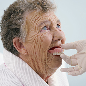 BoneLossCouldbetheReasonforYourLooseDentures