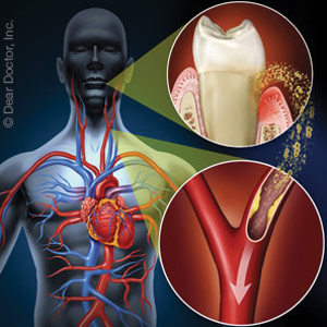 DiabeticswithGumDiseaseBenefitfromCoordinatingTreatmentforBoth