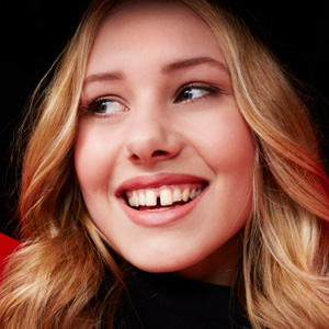 ClosingtheGapBetweenFrontTeethCanCreateaMoreAttractiveSmile