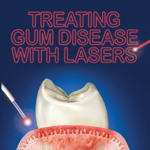 LasersPoisedtoTransformCurrentTreatmentforGumDisease