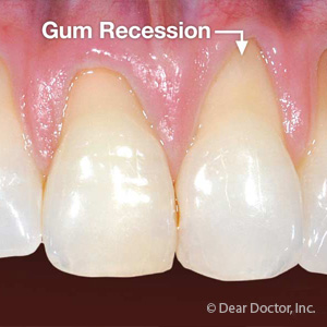 teeth and gums diseases