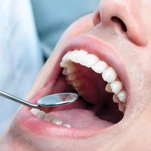 New Dental Advances Promise Better Outcomes for Treating Decay New Dental Advances Promise Better Outcomes for Treating Decay