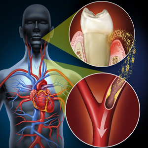 TheHealthofYourMouthCouldAffecttheRestofYourBody