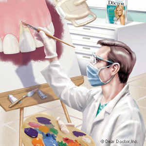 PeriodontalSurgerymaybeNeededtoHaltGumDiseaseandEncourageHealing