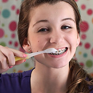 4WaystoAvoidDentalDiseaseWhileWearingBraces