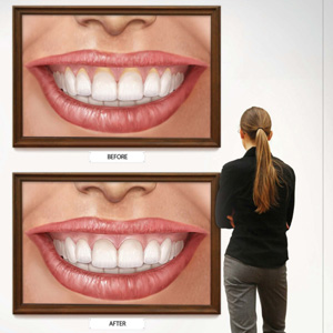 GumSurgeryCanImproveYourSmileandSaveYourTeeth