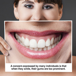 Finding the Right Solution for Your Gummy Smile Finding the Right Solution for Your Gummy Smile