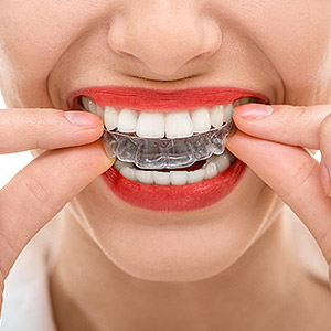 KeepYourNewStraightenedSmileStraightWithanOrthodonticRetainer
