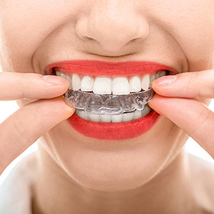 KeepYourNewStraightenedSmileStraightWithanOrthodonticRetainer