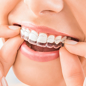 teeth moving after braces are removed