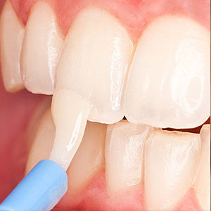 TopicalFluorideisaSafeWaytoProtectYourChildsTeethfromDecay