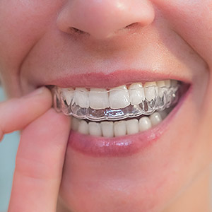 StraighteningYourTeethCouldRejuvenateYourSmile