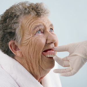 ChangesinBoneStructurecanAffectDentureFit