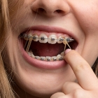 SomeBiteProblemsMayRequiretheHelpofOtherToolsinConjunctionWithBraces