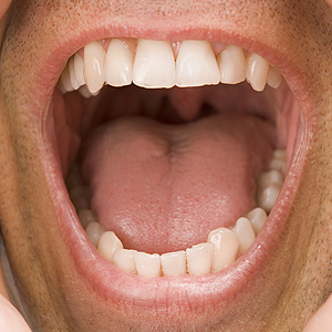 KeepYourSalivaFlowing-YourOralHealthDependsonit