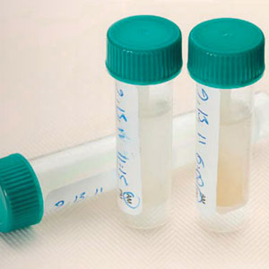 DiseaseDetection-SalivasNewRole
