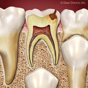 IfatAllPossiblePrimaryTeethareWorthSaving
