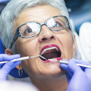RootDecayinYourLaterYearsCouldEndangerYourTeeth