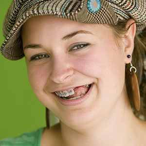 TeensBenefitMostfromATemporarySolutiontoMissingTeeth