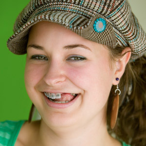 RemovingTeethCouldAidOrthodonticTreatment