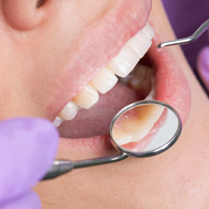 BoneGumsandImplants-KeepingaHealthyBalanceforaBeautifulSmile