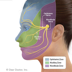 Facial Nerve Pain can be Managed with Effective Treatment