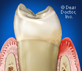 understanding-gum-disease.jpg