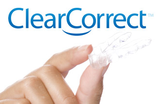 Clear aligners.