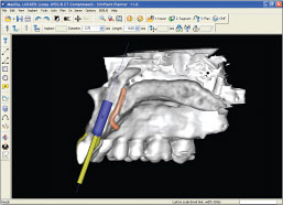 Cat Scan technology.