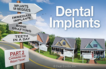 Dental implant options for care.