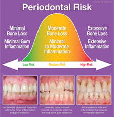Periodontal Risk.