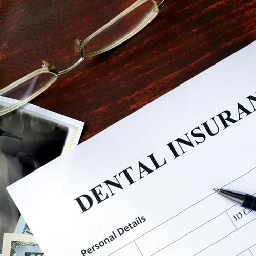 4 Things You Should Know About Your Dental Insurance