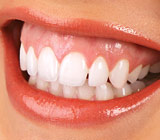 What to Do About a “Gummy” Smile