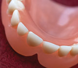 Are Immediate Dentures a Solution?