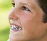 The Value of a Two-Phased Approach to Orthodontics