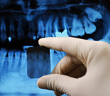 X-rays, Are They Safe and Necessary?